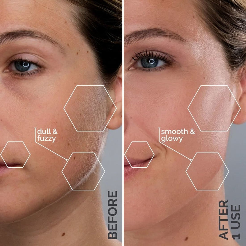 Pro Sonic Peach Fuzz Remover & Skin Smoother
